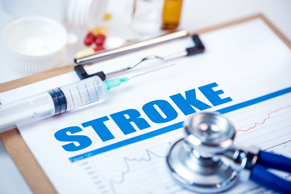 How Much Do You Really Know About Stroke?