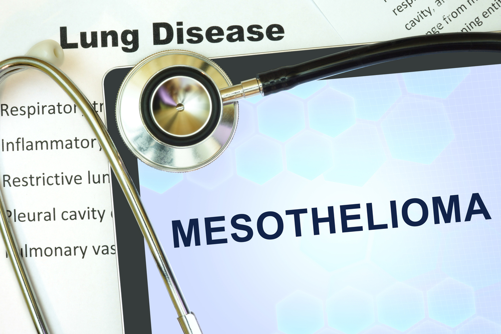 Frequently Asked Questions about Mesothelioma