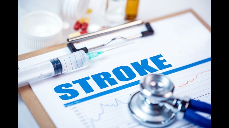 How Much Do You Really Know About Stroke?