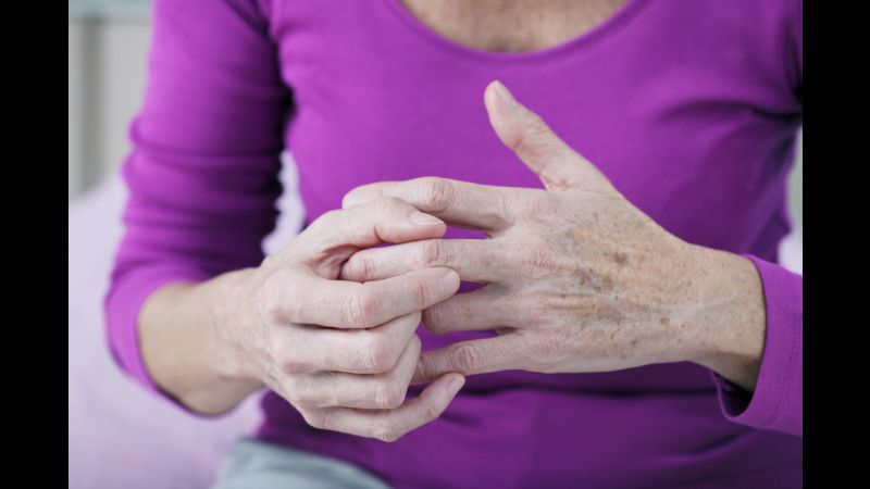 Suffering From Rheumatoid Arthritis?  Losing Weight Might Help