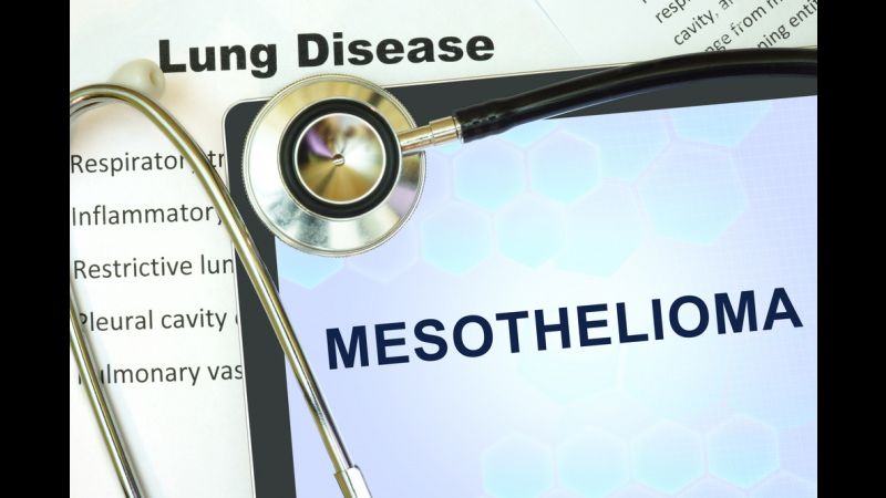 Frequently Asked Questions about Mesothelioma